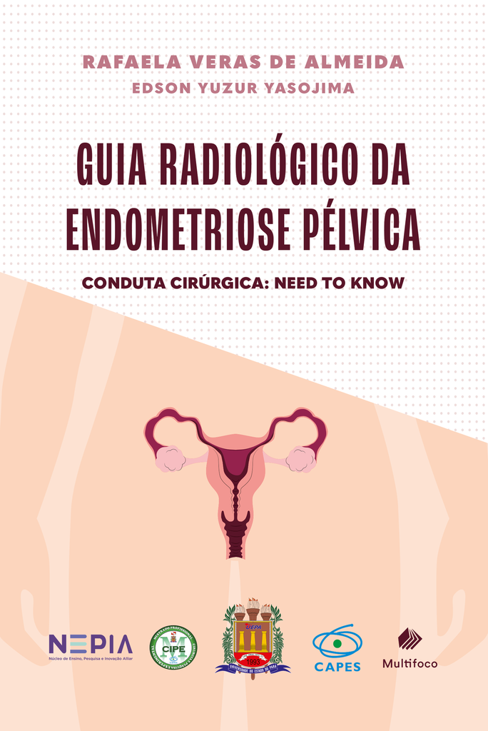 GUIA RADIOLÓGICO DA ENDOMETRIOSE PÉLVICA - Conduta cirúrgica: Need to know