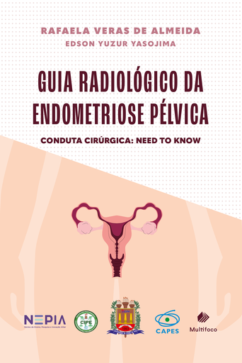 GUIA RADIOLÓGICO DA ENDOMETRIOSE PÉLVICA - Conduta cirúrgica: Need to know